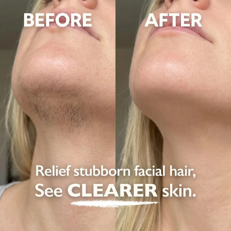 CLEARER SKIN, LESS BLOATING, MORE CONFIDENCE