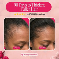 Myo-Inotisol Horomone Complex Hair Solution